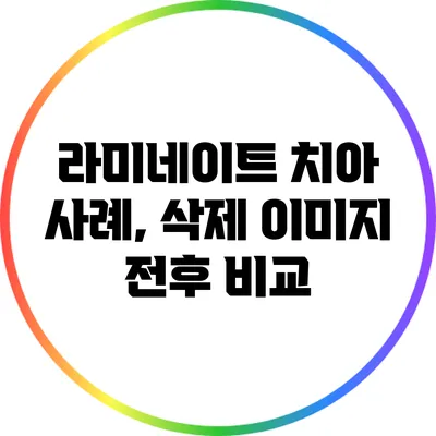 라미네이트 치아 사례, 삭제 이미지 전후 비교